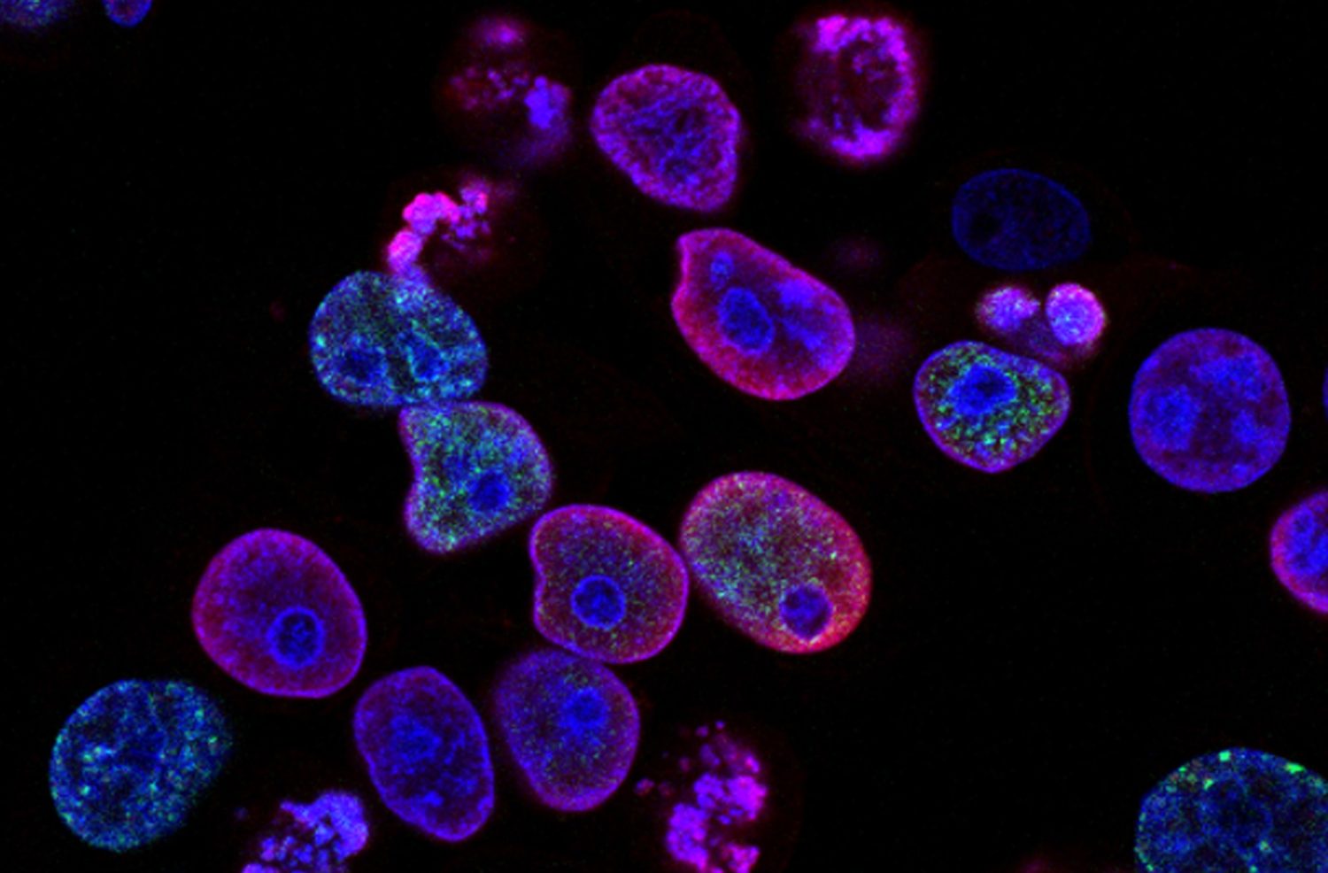 tumori rna